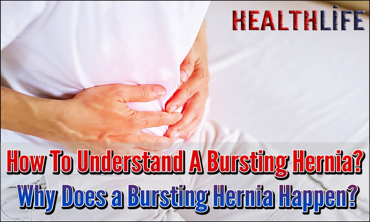 How To Understand A Bursting Hernia
