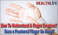 How To Understand A Finger Fracture