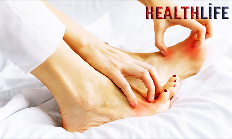 Is Heel Itching A Symptom Of Diabetes