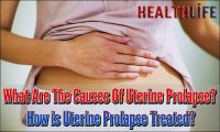What Are The Causes Of Uterine Prolapse