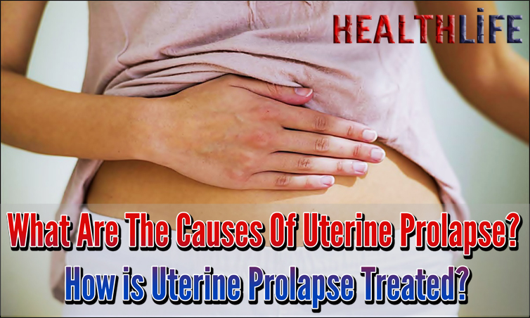 What Are The Causes Of Uterine Prolapse