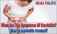 What Are The Symptoms Of Cervicitis