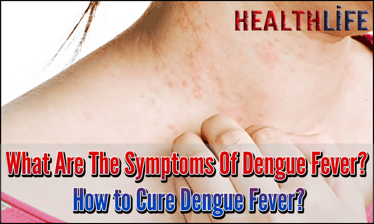 What Are The Symptoms Of Dengue Fever