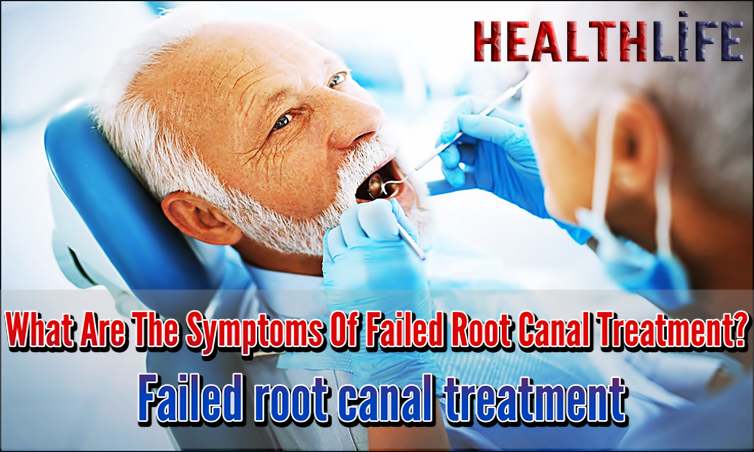 What Are The Symptoms Of Failed Root Canal Treatment