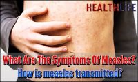 What Are The Symptoms Of Measles