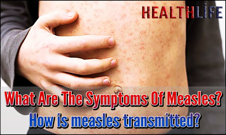 What Are The Symptoms Of Measles