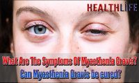 What Are The Symptoms Of Myasthenia Gravis