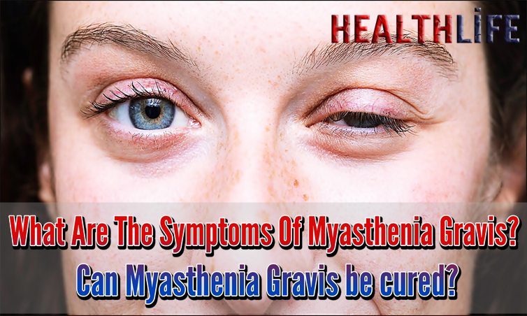What Are The Symptoms Of Myasthenia Gravis