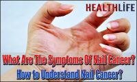 What Are The Symptoms Of Nail Cancer