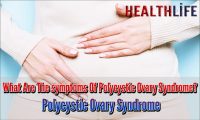 What Are The symptoms Of Polycystic Ovary Syndrome