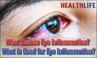 What Causes Eye Inflammation