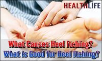 What Causes Heel Itching