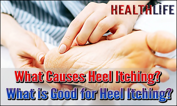 What Causes Heel Itching