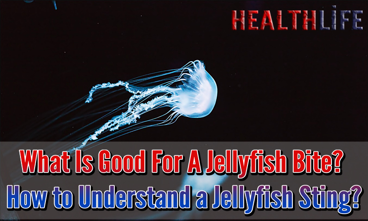 What Is Good For A Jellyfish Bite