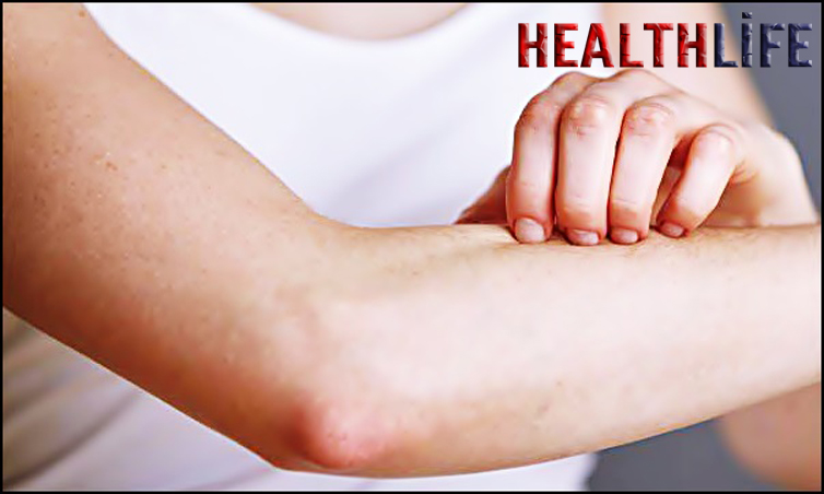 What Symptoms Come First In Dengue