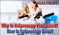 Why Is Colposcopy Performed