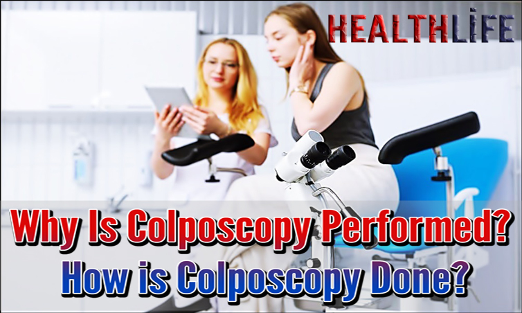 Why Is Colposcopy Performed
