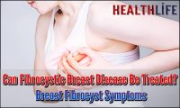 Can Fibrocystic Breast Disease Be Treated