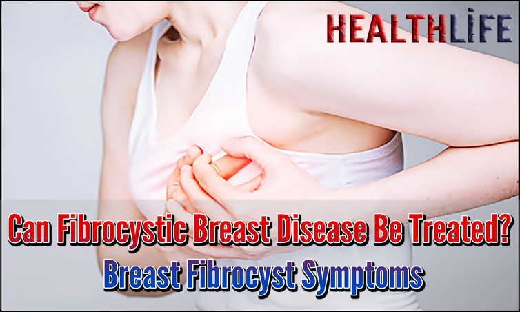 Can Fibrocystic Breast Disease Be Treated