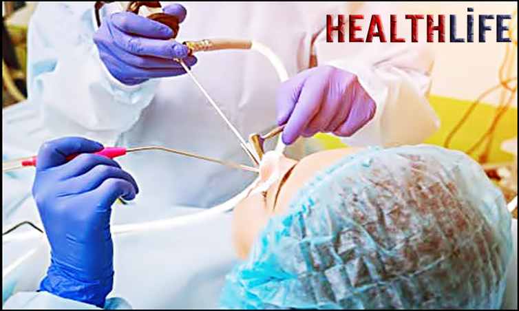 How Do They Determine If You Need Sinus Surgery