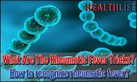 What Are The Rheumatic Fever Tricks