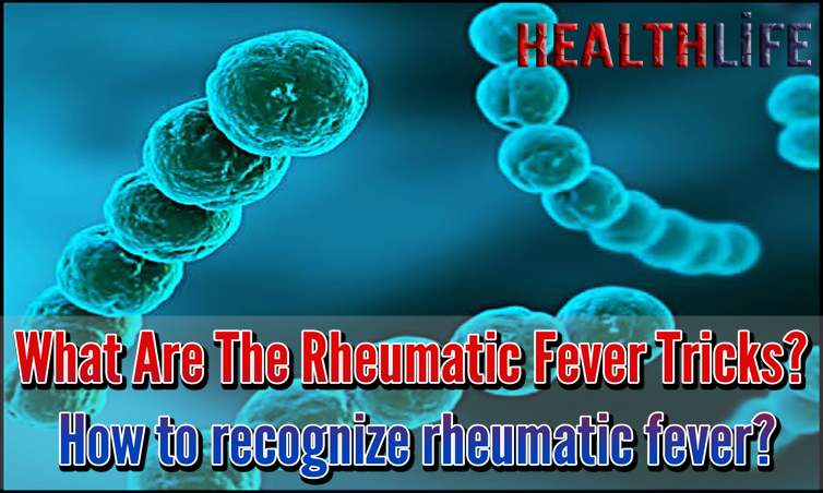 What Are The Rheumatic Fever Tricks