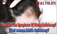 What Are The Symptoms Of Biotin Deficiency