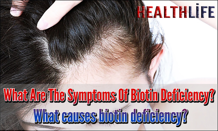 What Are The Symptoms Of Biotin Deficiency