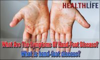 What Are The Symptoms Of Hand-Foot Disease