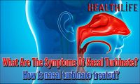 What Are The Symptoms Of Nasal Turbinate