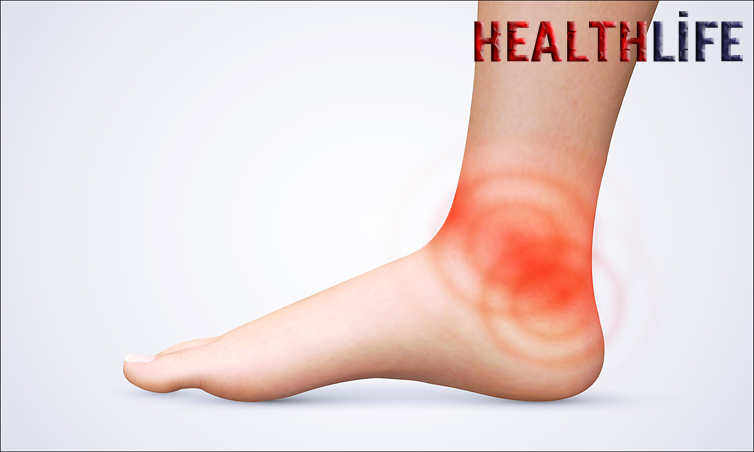 What Can Cause Ankle Pain Without Injury