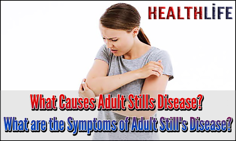 What Causes Adult Stills Disease