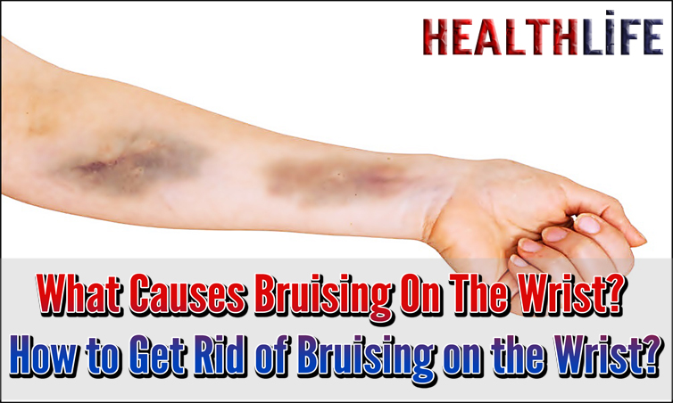 What Causes Bruising On The Wrist
