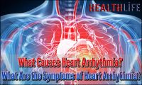 What Causes Heart Arrhythmia