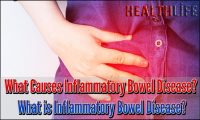 What Causes Inflammatory Bowel Disease
