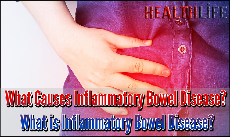 What Causes Inflammatory Bowel Disease