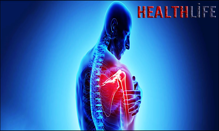 What Causes Pericapsulitis Of The Shoulder