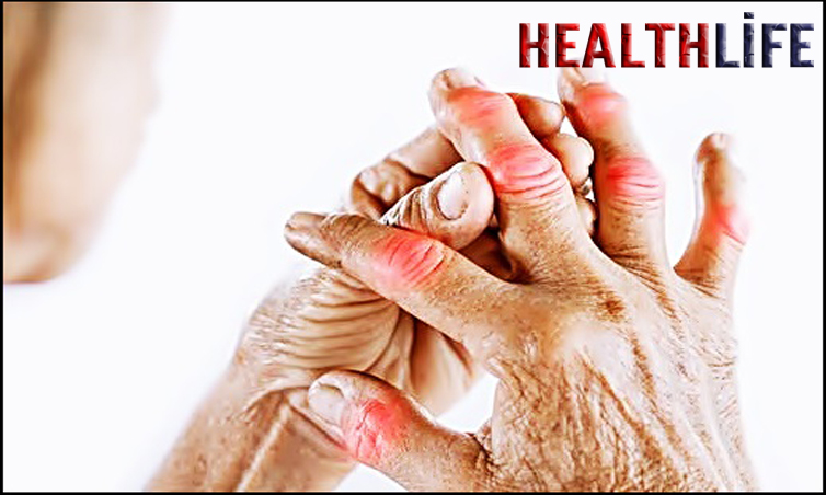 What Diseases Cause Finger Pain