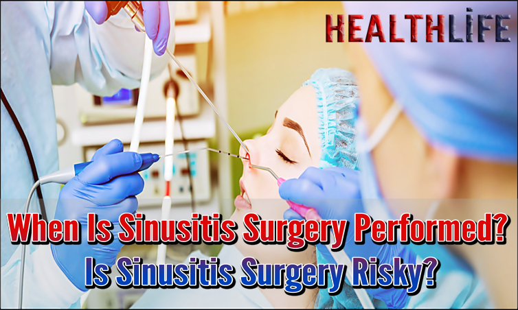 When Is Sinusitis Surgery Performed