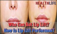 Who Can Get Lip Lift