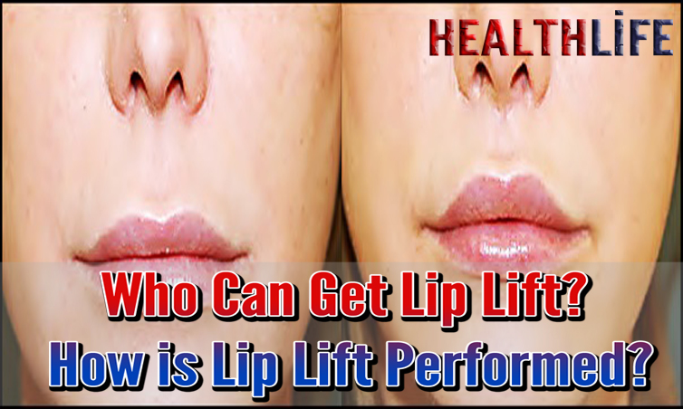 Who Can Get Lip Lift