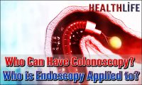 Who Can Have Colonoscopy
