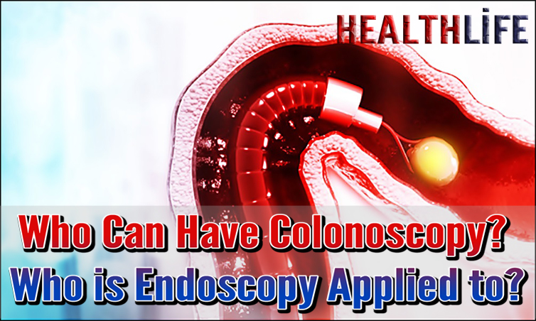 Who Can Have Colonoscopy
