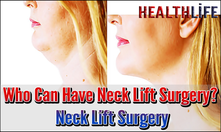 Who Can Have Neck Lift Surgery