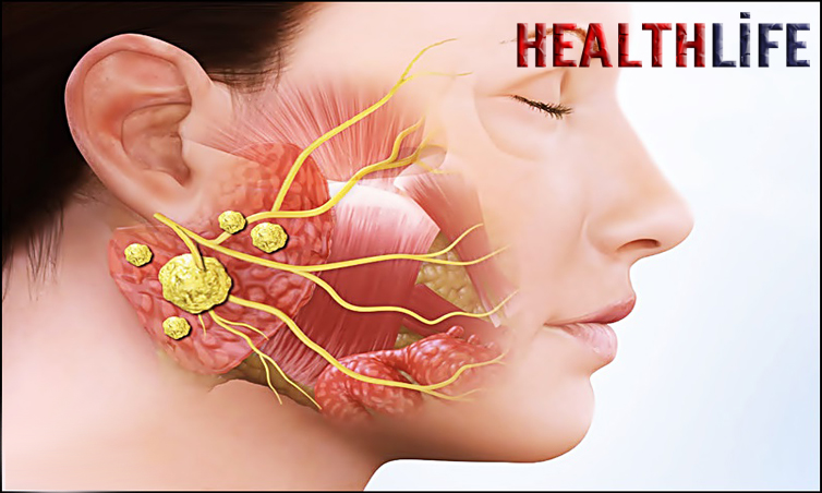 How Do You Diagnose A Salivary Gland Disease