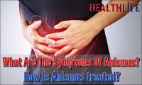 What Are The Symptoms Of Anismus