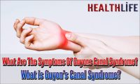 What Are The Symptoms Of Guyons Canal Syndrome