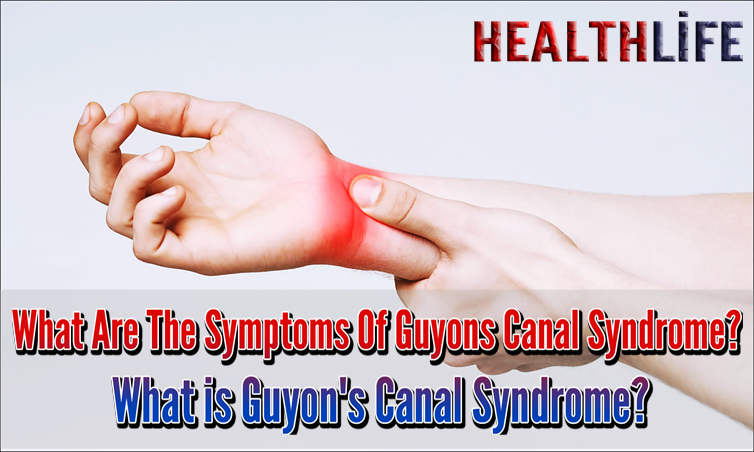 What Are The Symptoms Of Guyons Canal Syndrome