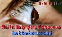 What Are The Symptoms Of Keratoconus