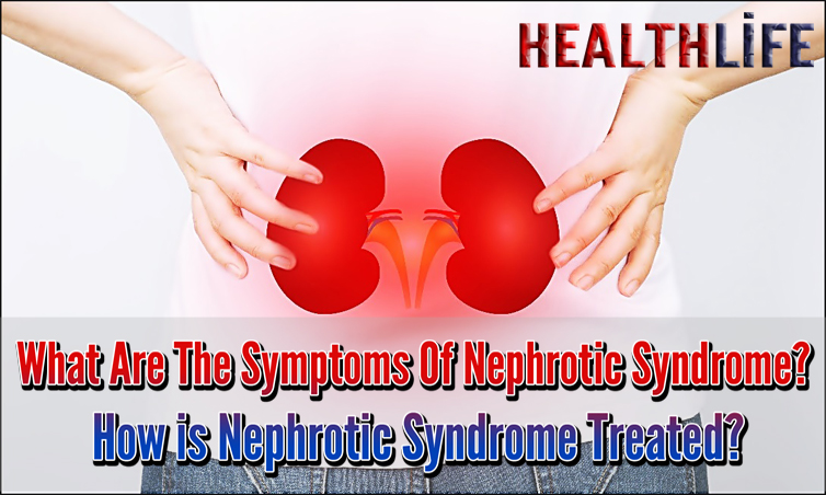 What Are The Symptoms Of Nephrotic Syndrome